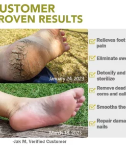 AEXZR™ Foot Medication Effervescent Pills