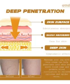 ATTDX VeinRenewal SmoothLegs Cream