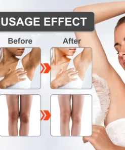 Awzlove™ Peeling Advanced Whitening Cream