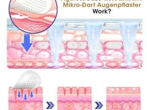 Biancat™ AgelessGaze Koreanische Mikro-Dart Augenpflaster