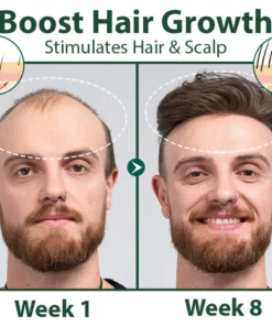 Biancat™ HairRegen RedGinseng Spray