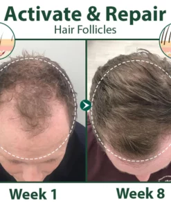 Biancat™ HairRegen RedGinseng Spray