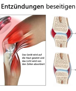 Biancat™ Handgerät zur Kaltlaser-Schmerzbehandlung