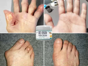 Biancat™ InflaGuard Bee Venom Joint and Bone Pain Relief Cream