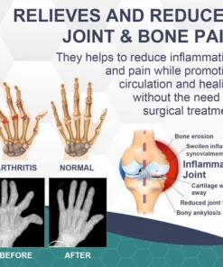 Biancat™ InflaGuard Bee Venom Joint and Bone Pain Relief Cream