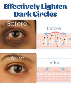 Biancat™ Retinol Renewal Eye Cream