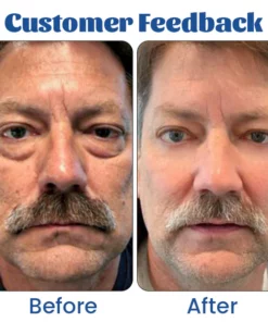 Biancat™ Retinol Renewal Eye Cream