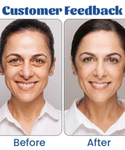 Biancat™ Retinol Renewal Eye Cream