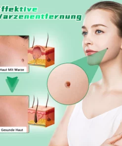 Biancat™ SilkAura Warzenentferner Seife