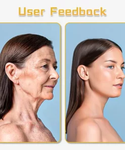 Biancat™ UltraRenew Ultrasonic Facelift Device