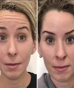 CC™ 30 Days Advanced Collagen Boost Anti-Aging Botox Face Serum