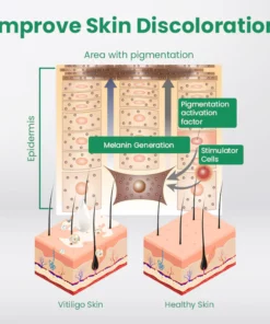 CC™ VitiligoCare Revitalizing Elixir