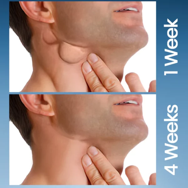 Ceoerty™ ThyroHeal Schilddrüs Lymphknäppchen Patch