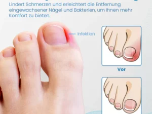 Ceoerty™ Anti-Paronychia Nagelbehandlungs-Gel
