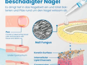 Ceoerty™ Anti-Paronychia Nagelbehandlungs-Gel