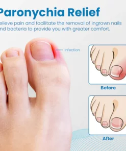 Ceoerty™ Anti-Paronychia Nail Treatment Gel