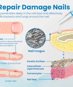 Ceoerty™ Anti-Paronychia Nail Treatment Gel