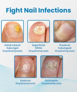 Ceoerty™ Anti-Paronychia Nail Treatment Gel