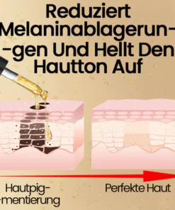 Ceoerty™ ClearTouch Perfekte Haut Anti-Fleck Serum