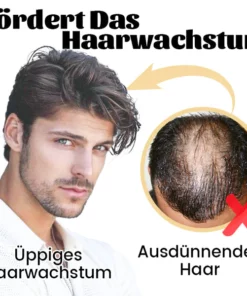 Ceoerty™ HGrow Reiswasser Haar-Essenz