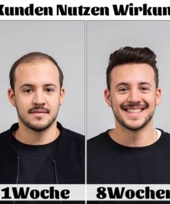 Ceoerty™ HGrow Reiswasser Haar-Essenz