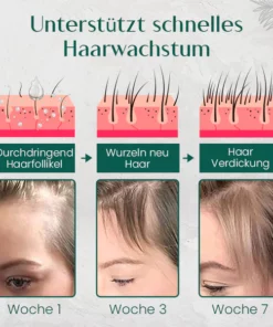 Ceoerty™ HairRenew Pro Wachstumsserum