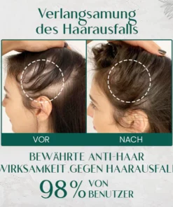 Ceoerty™ HairRenew Pro Wachstumsserum