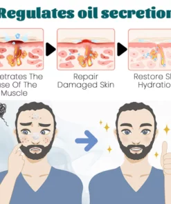 Ceoerty™ Men's AcneFree Hydra Cream