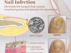 Ceoerty™ PROStrength Ultimate Nail Repair Serum
