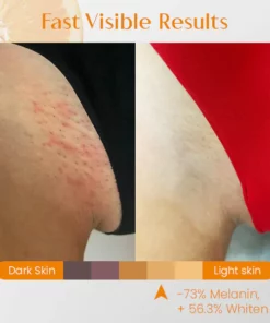 Ceoerty™ RadiantGLOW Vitamin C Soap