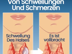 Ceoerty™ ThyroHeal Schilddrüsenlymphknoten-Patch