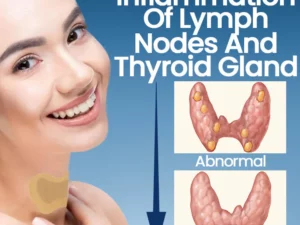 Ceoerty™ ThyroHeal Thyroid Lymph Node Patch