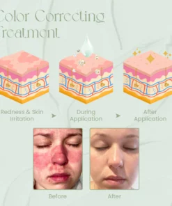 Ceoerty™ ToneTreat Skin Correcting Treatment Cream