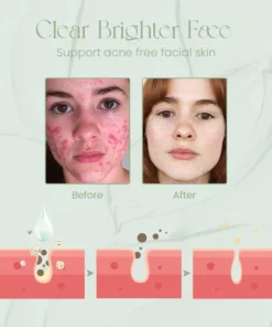 Ceoerty™ ToneTreat Skin Correcting Treatment Cream