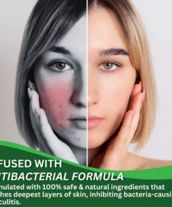 ClearFX™ Anti-Follikulitis-Balsam