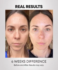 DermaPro™ LED Light-Therapy Revitalizing Mask