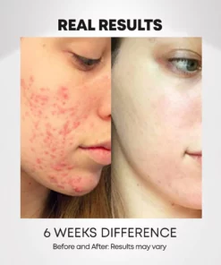 DermaPro™ LED Light-Therapy Revitalizing Mask