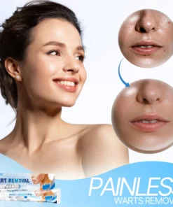 Dr. W's Wart Removal Ointment