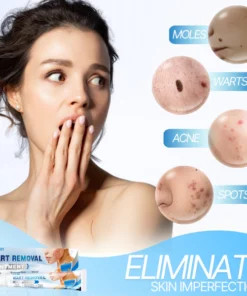 Dr. W's Wart Removal Ointment