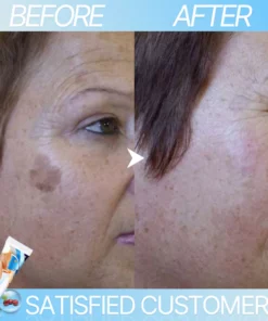 Dr. W's Wart Removal Ointment