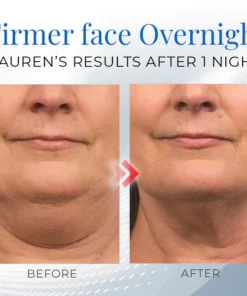 Firmio™ Sleeping V-Face Beauty Device