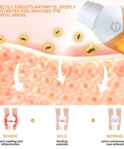 Fivfivgo™ Bienengift Gelenk- und Knochentherapie Spray