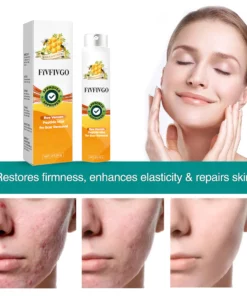 Fivfivgo™ Bienengift-Peptid-Nebel zur Narbenentfernung