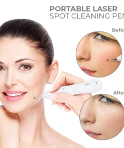 Fivfivgo™ Tragbarer Laser-Punktreinigungsstift