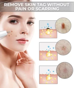 Fivfivgo™ Tragbarer Laser-Punktreinigungsstift