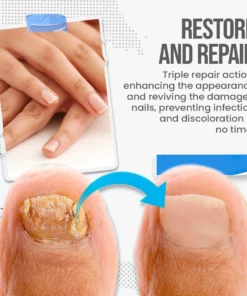 FungusShield Nail Treatment Cream