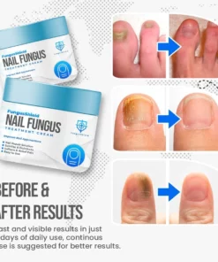 FungusShield Nail Treatment Cream