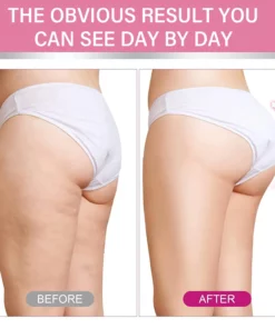 Furzero™ Backside Lifting & Shaping Cream