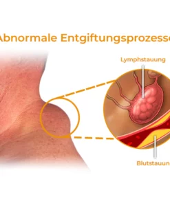 GFOUK™ Bildhauerei Lymphdrainage Entgiftungscreme