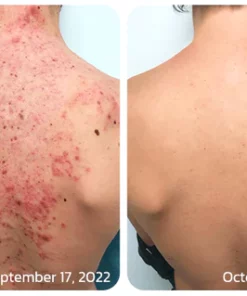 GFOUK™ BodyTreat Collagen Exfoliating Essence